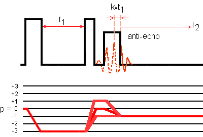 Z-filtered MQMAS sequence and SPAM antiecho transfer pathways for a spin I = 5/2